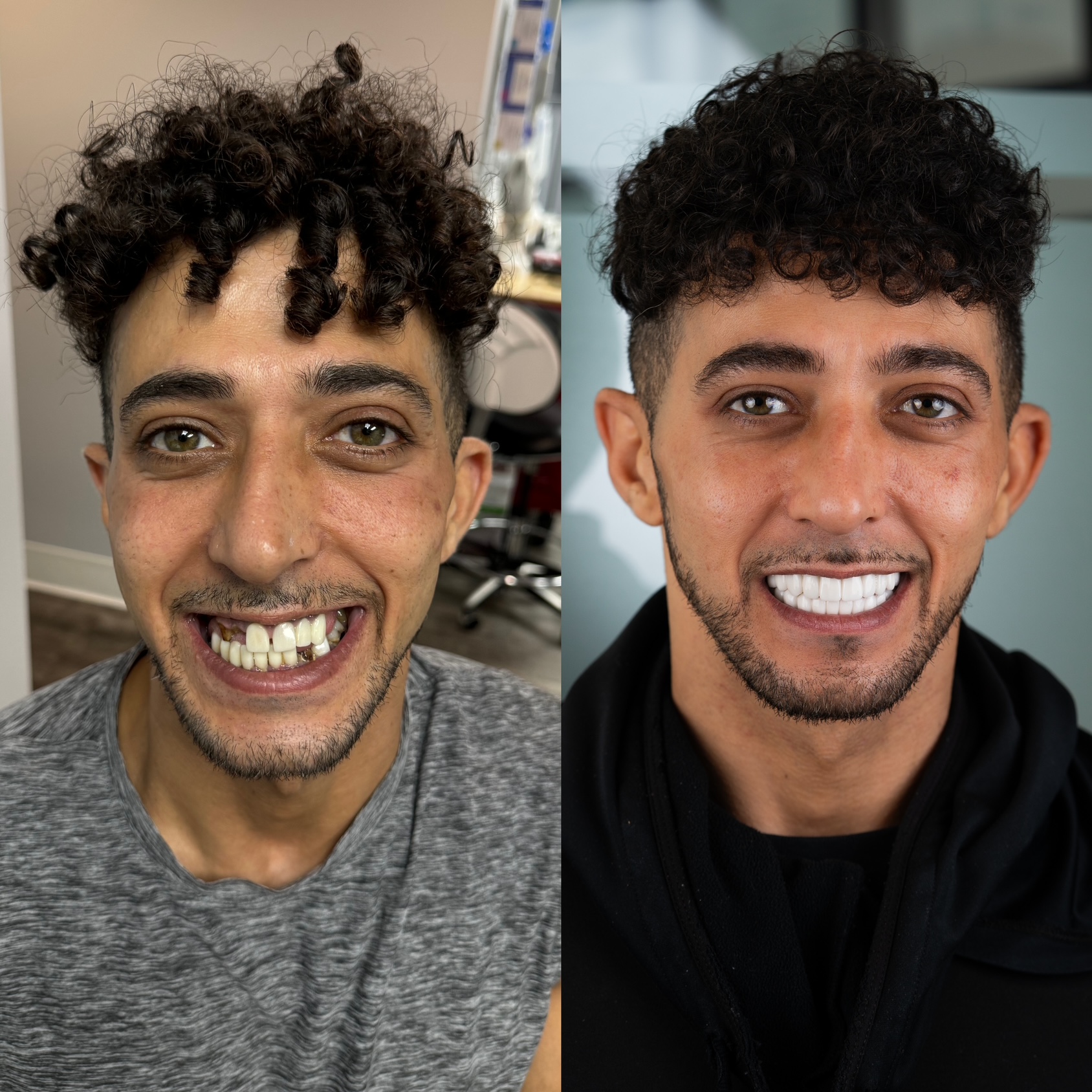 Beige Minimalist Skincare Before and After Instagram Post 1