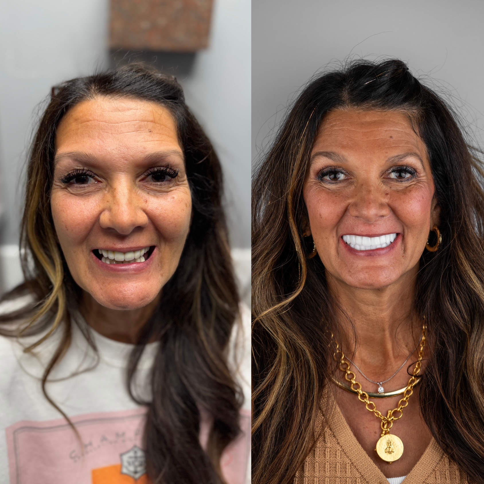 Beige Minimalist Skincare Before and After Instagram Post 1